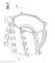 Fig. 10 - Paddle style land fill compactor wheel tip