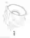 Fig. 15 - Land fill compactor wheel tip assembly