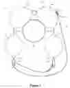 Fig. 02 - Pipeline Weighting Device and Method