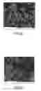 Fig. 03 - BONE TISSUE REGENERATION WITH CALCIFIED SUBSTANCE PRODUCED BY CULTURED CELLS