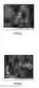 Fig. 04 - BONE TISSUE REGENERATION WITH CALCIFIED SUBSTANCE PRODUCED BY CULTURED CELLS