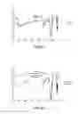 Fig. 05 - BONE TISSUE REGENERATION WITH CALCIFIED SUBSTANCE PRODUCED BY CULTURED CELLS