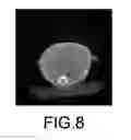 Fig. 10 - BONE TISSUE REGENERATION WITH CALCIFIED SUBSTANCE PRODUCED BY CULTURED CELLS