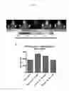 Fig. 03 - METHOD FOR EARLY IMAGING OF ATHEROSCLEROSIS