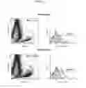Fig. 12 - METHOD FOR EARLY IMAGING OF ATHEROSCLEROSIS