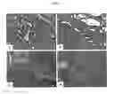 Fig. 03 - COMPOSITIONS AND METHODS OF USE OF TARGETING PEPTIDES FOR DIAGNOSIS AND THERAPY OF HUMAN CANCER