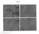 Fig. 13 - COMPOSITIONS AND METHODS OF USE OF TARGETING PEPTIDES FOR DIAGNOSIS AND THERAPY OF HUMAN CANCER