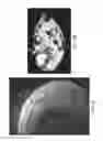 Fig. 07 - Macrophage-Enhanced MRI (MEMRI) in a Single Imaging Session