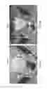 Fig. 08 - Macrophage-Enhanced MRI (MEMRI) in a Single Imaging Session