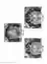 Fig. 09 - Macrophage-Enhanced MRI (MEMRI) in a Single Imaging Session