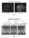 Fig. 03 - HYDROGEL-FORMING COMPOSITION COMPRISING NATURAL AND SYNTHETIC SEGMENTS