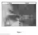 Fig. 08 - Bone-like prosthetic implants
