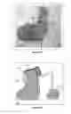 Fig. 19 - Bone-like prosthetic implants
