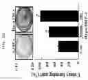 Fig. 03 - METHOD FOR DEDIFFERENTIATING ADIPOSE TISSUE STROMAL CELLS