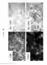 Fig. 10 - METHOD FOR DEDIFFERENTIATING ADIPOSE TISSUE STROMAL CELLS