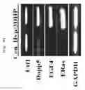 Fig. 15 - METHOD FOR DEDIFFERENTIATING ADIPOSE TISSUE STROMAL CELLS
