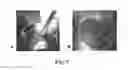 Fig. 10 - Compositions and Methods of Using Living and Non-Living Bioactive Devices with Components Derived from Self-Renewing Colony Forming Cells Cultured and Expanded In Vitro