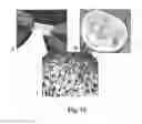 Fig. 11 - Compositions and Methods of Using Living and Non-Living Bioactive Devices with Components Derived from Self-Renewing Colony Forming Cells Cultured and Expanded In Vitro