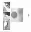 Fig. 42 - Compositions and Methods of Using Living and Non-Living Bioactive Devices with Components Derived from Self-Renewing Colony Forming Cells Cultured and Expanded In Vitro