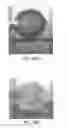 Fig. 62 - Compositions and Methods of Using Living and Non-Living Bioactive Devices with Components Derived from Self-Renewing Colony Forming Cells Cultured and Expanded In Vitro