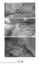 Fig. 63 - Compositions and Methods of Using Living and Non-Living Bioactive Devices with Components Derived from Self-Renewing Colony Forming Cells Cultured and Expanded In Vitro