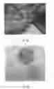 Fig. 64 - Compositions and Methods of Using Living and Non-Living Bioactive Devices with Components Derived from Self-Renewing Colony Forming Cells Cultured and Expanded In Vitro