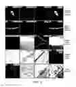 Fig. 03 - Lateral ventricle cell compositions and use for treating neural degenerative diseases