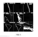 Fig. 04 - Lateral ventricle cell compositions and use for treating neural degenerative diseases