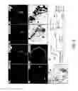 Fig. 06 - Lateral ventricle cell compositions and use for treating neural degenerative diseases