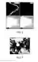 Fig. 07 - Lateral ventricle cell compositions and use for treating neural degenerative diseases