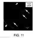Fig. 10 - Lateral ventricle cell compositions and use for treating neural degenerative diseases