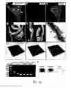 Fig. 11 - Lateral ventricle cell compositions and use for treating neural degenerative diseases