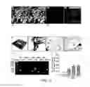 Fig. 12 - Lateral ventricle cell compositions and use for treating neural degenerative diseases