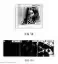Fig. 13 - Lateral ventricle cell compositions and use for treating neural degenerative diseases