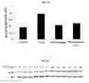 Fig. 09 - VALPROIC ACID, DERIVATIVES, ANALOGUES, AND COMPOSITIONS INCLUDING SAME AND METHODS FOR THEIR THERAPEUTIC USE