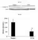 Fig. 12 - VALPROIC ACID, DERIVATIVES, ANALOGUES, AND COMPOSITIONS INCLUDING SAME AND METHODS FOR THEIR THERAPEUTIC USE