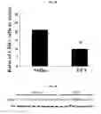 Fig. 15 - VALPROIC ACID, DERIVATIVES, ANALOGUES, AND COMPOSITIONS INCLUDING SAME AND METHODS FOR THEIR THERAPEUTIC USE