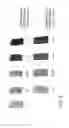 Fig. 03 - Methods and apparatus for manufacturing plasma based plastics and bioplastics produced therefrom