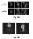 Fig. 101 - CNS delivery of therapeutic agents