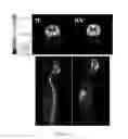 Fig. 116 - CNS delivery of therapeutic agents