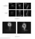 Fig. 117 - CNS delivery of therapeutic agents