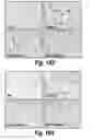Fig. 152 - CNS delivery of therapeutic agents