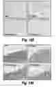 Fig. 153 - CNS delivery of therapeutic agents