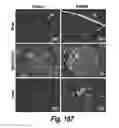 Fig. 154 - CNS delivery of therapeutic agents