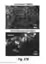 Fig. 35 - CNS delivery of therapeutic agents