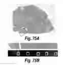 Fig. 58 - CNS delivery of therapeutic agents