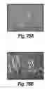 Fig. 59 - CNS delivery of therapeutic agents