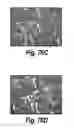 Fig. 60 - CNS delivery of therapeutic agents