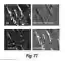 Fig. 61 - CNS delivery of therapeutic agents