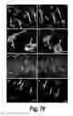 Fig. 62 - CNS delivery of therapeutic agents